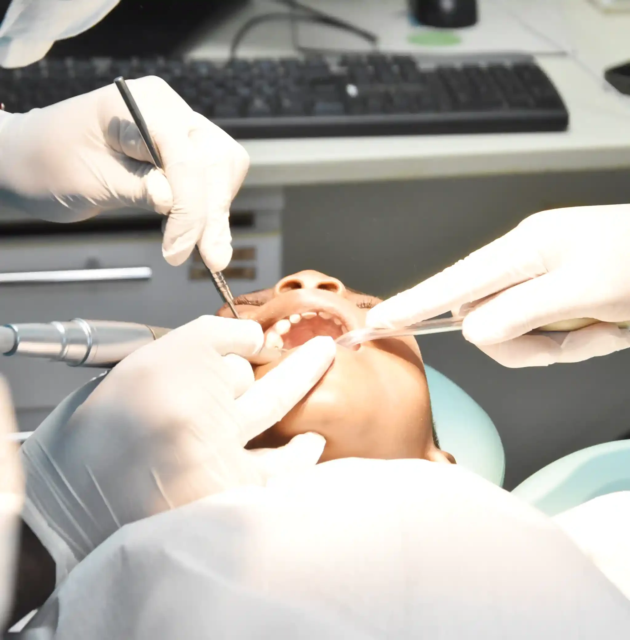 Chirugie buccal 1